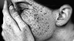Freckles