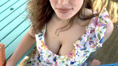 Freckles Jessica Paré