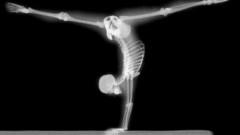 Gymnast X-ray Bones