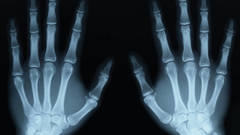 Hands anatomy X-ray
