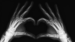 Hands black background Hearts Bones X-ray monochrome