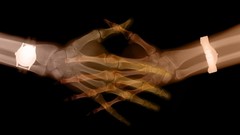 Hands Bones X-ray x-ray potograpy