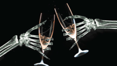 Hands glasses skeletons X-ray