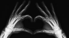 Hands X-ray Hearts