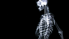 Headphones skeletons