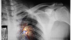 Heartxray lets see some