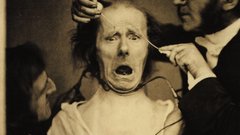 High boulogne Resolution duchenne