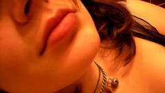 High Resolution dopo frammento