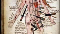 Man high wound wellcome Resolution