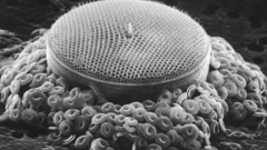 Microscopic Hearts love