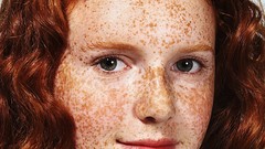 Redheads freckles