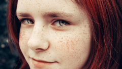Redheads freckles