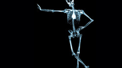 Skeletons X-ray