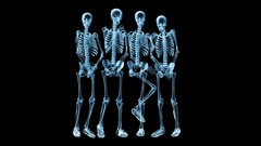 Skeletons X-ray