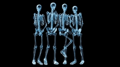 Skeletons X-ray black background