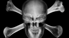 Skulls skull and crossbones