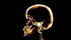 Skulls X-ray