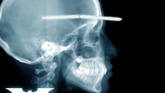 The joker skeletons X-ray