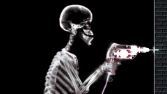 Wall skeletons drill X-ray