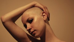 Woman bald