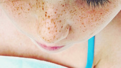 Woman close-up freckles