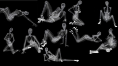 Woman high heels X-ray
