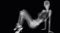 Woman legs models nude Xray high heels