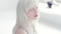 Woman white hair albino
