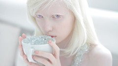 Woman white hair cups purple eyes albino