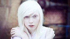 Woman white hair purple eyes albino