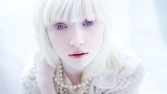 Woman white hair purple eyes albino