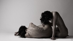 Woman Yakovlev anorexic anorexia