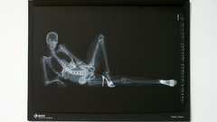 X-ray