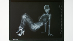 X-ray