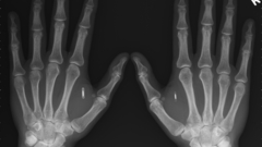 X-ray