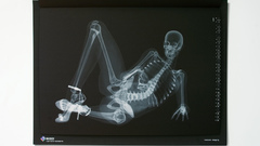 X-ray nude