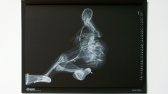 X-ray nude
