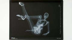 X-ray nude