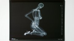 X-ray nude