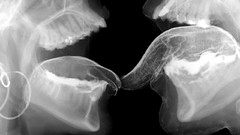X-ray tongue skulls