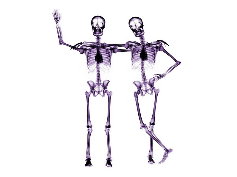 Two Skeletons in X-ray Style