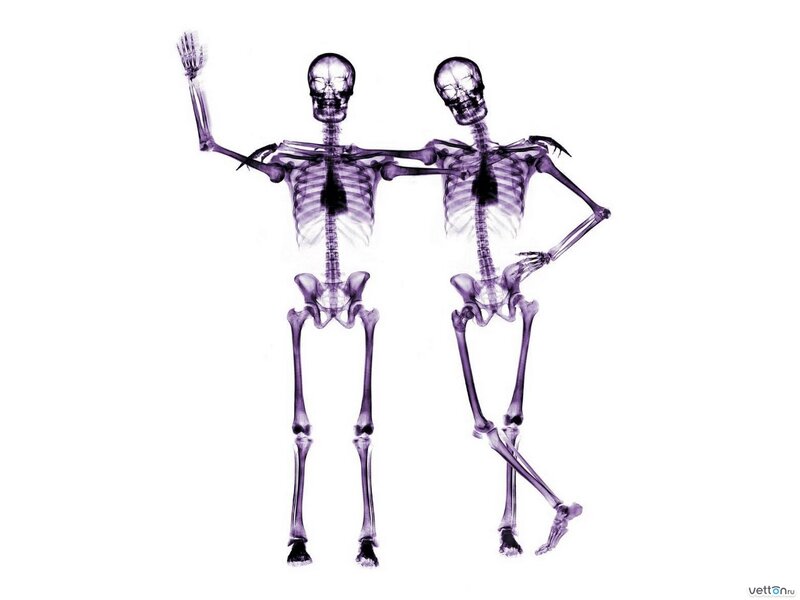 Two Skeletons Standing