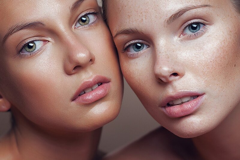 two women with freckles