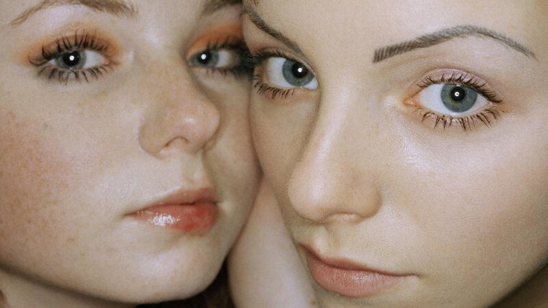 two women with freckles