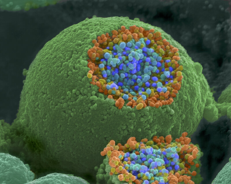 Virus-infected cell under microscope