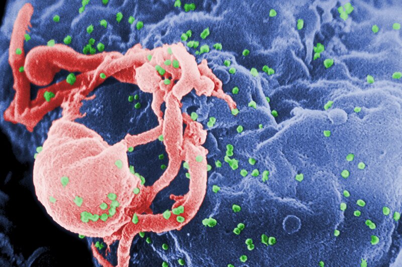 Virus on cell surface
