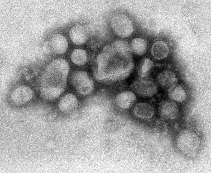 Virus Particles under Microscope — Gray
