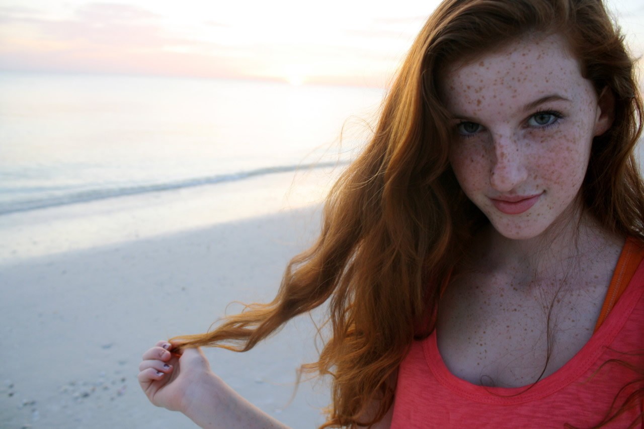 Freckles redheads.