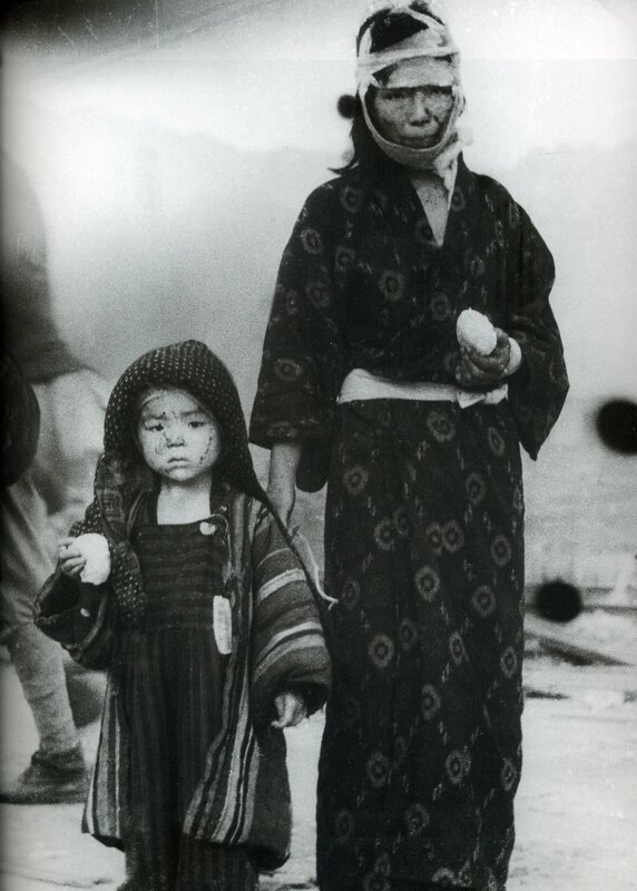 Woman and child after atomic bombing