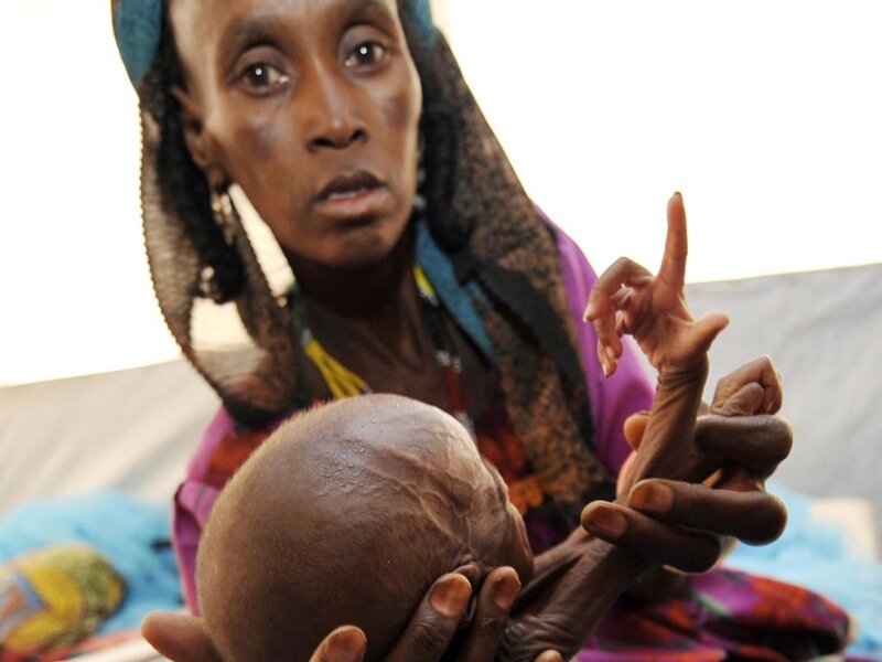 Woman Holding Malnourished Child — Brown